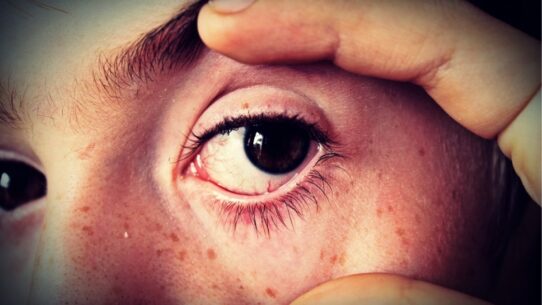 common causes of eye problems