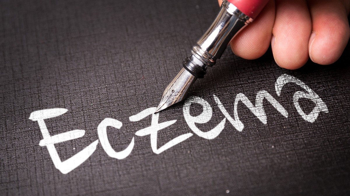 Eczema problems