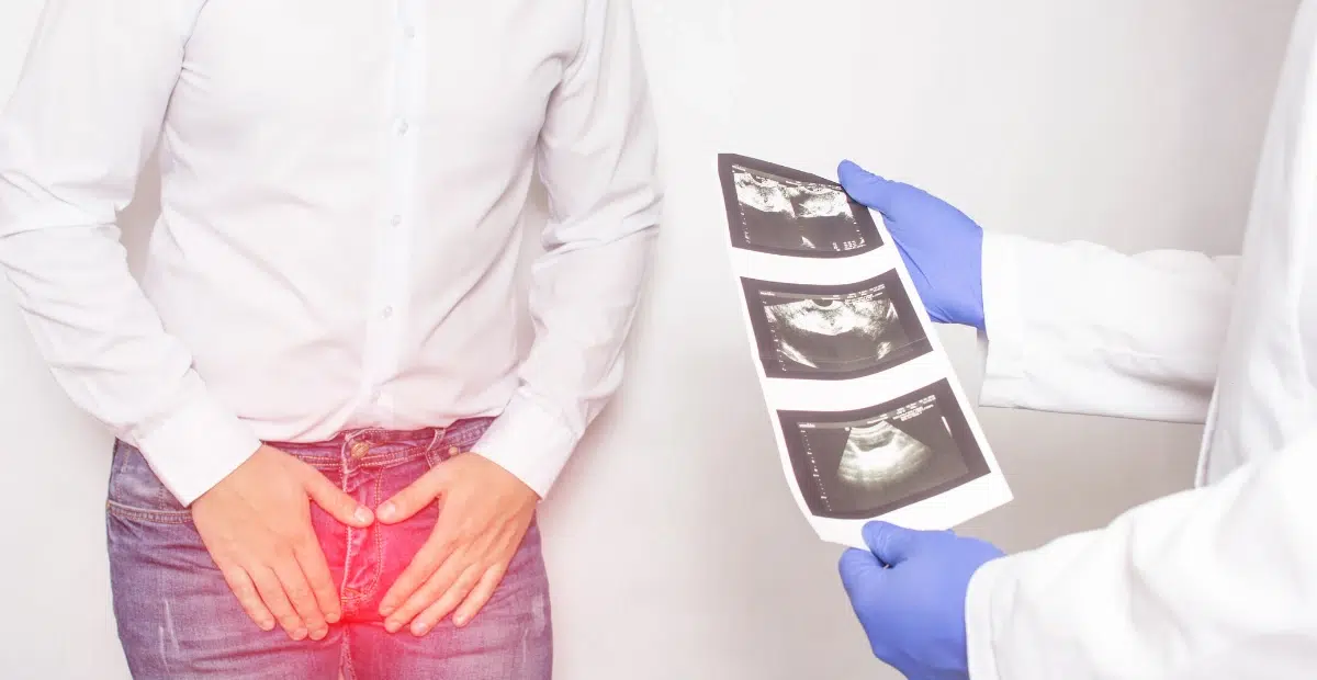 how long does erectile dysfunction last after prostate surgery