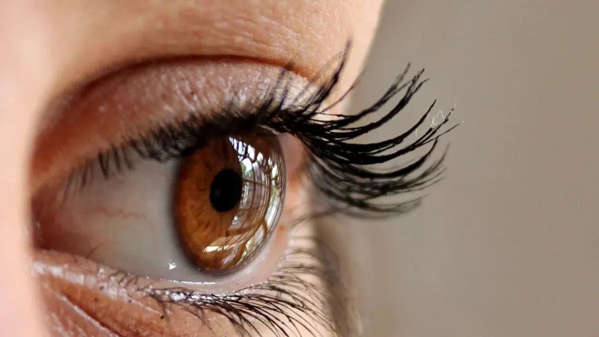 Can Bimatoprost Cause Eye Color Changes