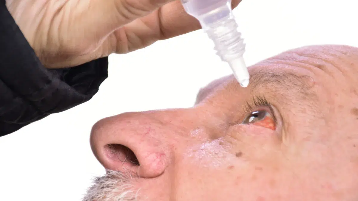 bimatoprost warnings