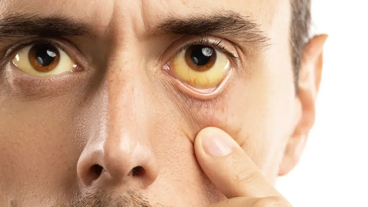 cataracts vs glaucoma