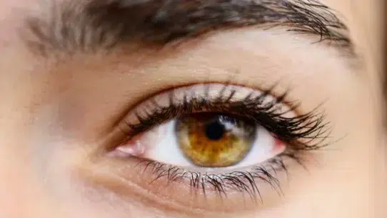 glaucoma natural treatment