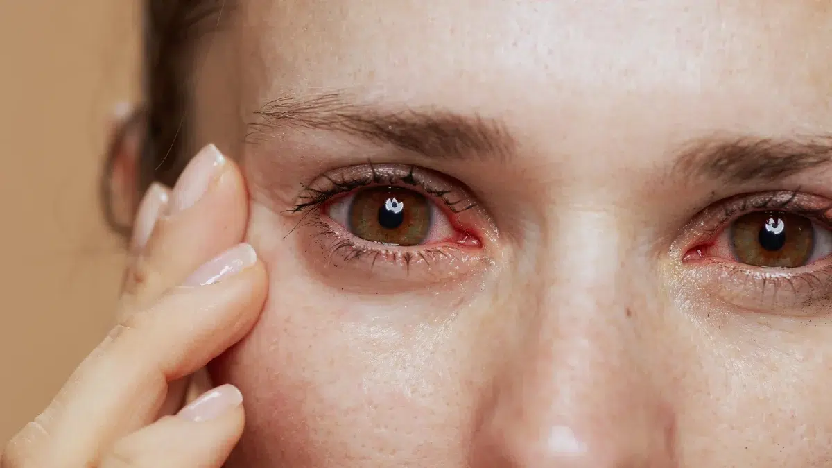 glaucoma treatment