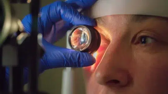 how to prevent glaucoma