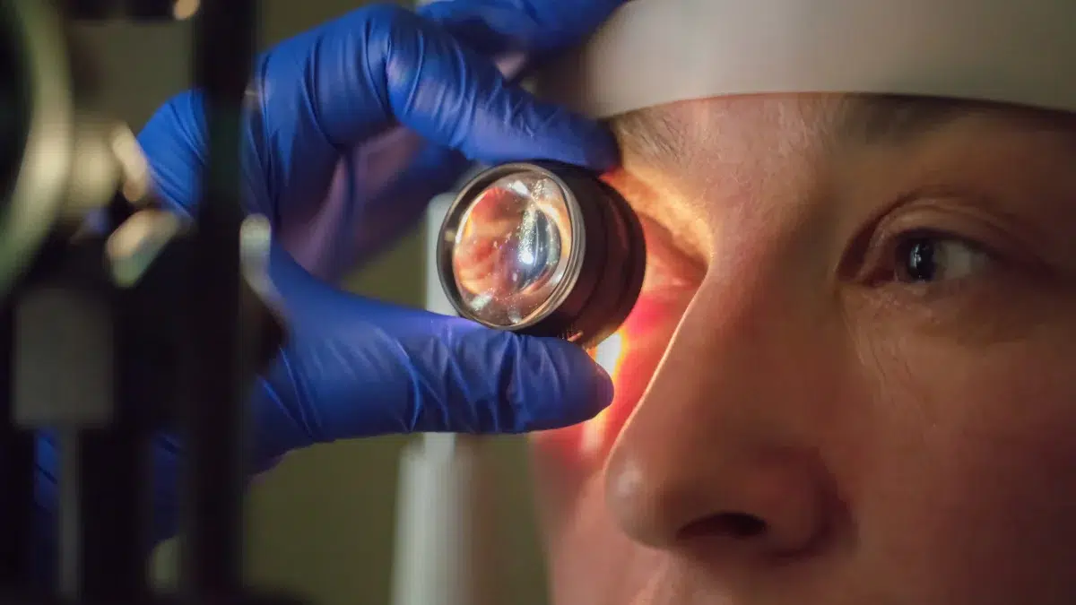 how to prevent glaucoma