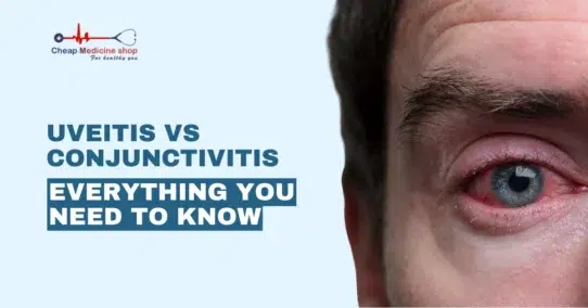 Uveitis vs Conjunctivitis