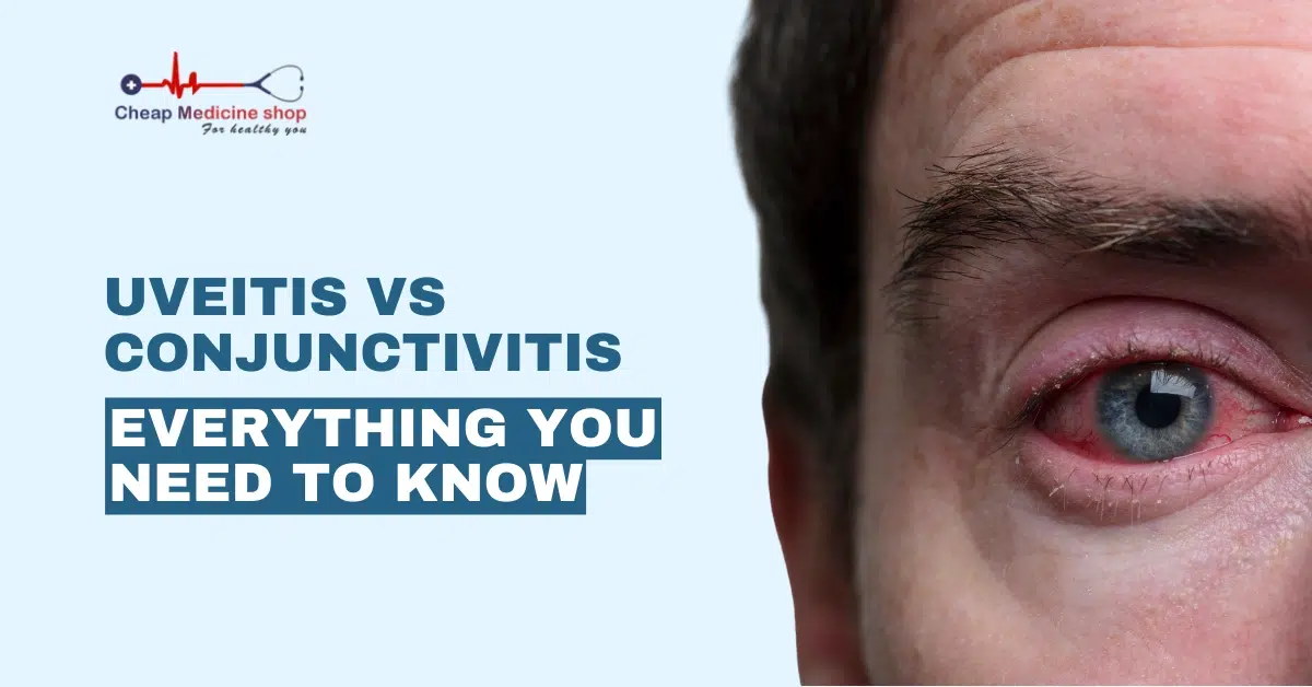 Uveitis vs Conjunctivitis