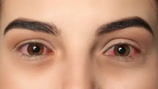 can pink eye cause blindness