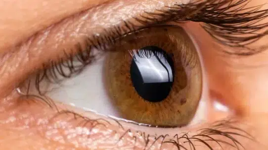 marginal keratitis
