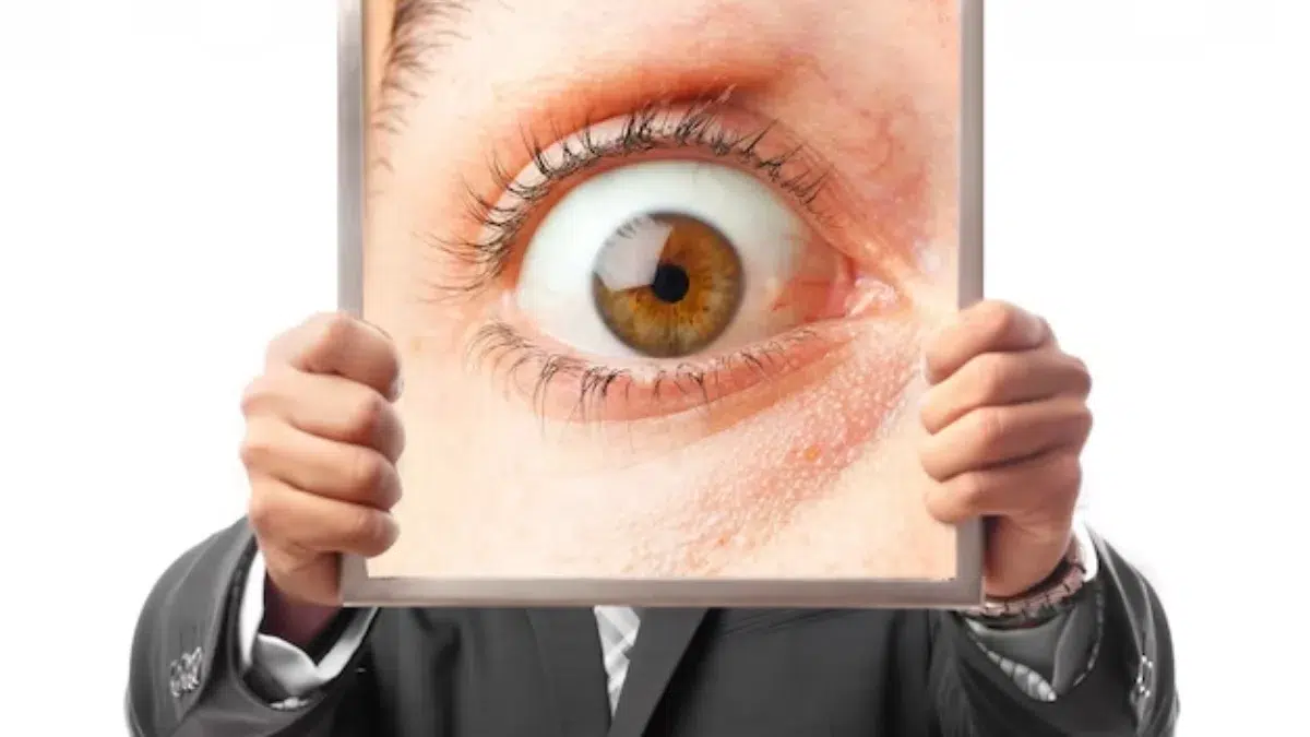 viral eye infection