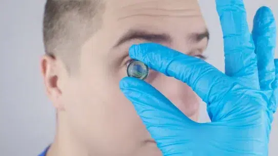 cataracts