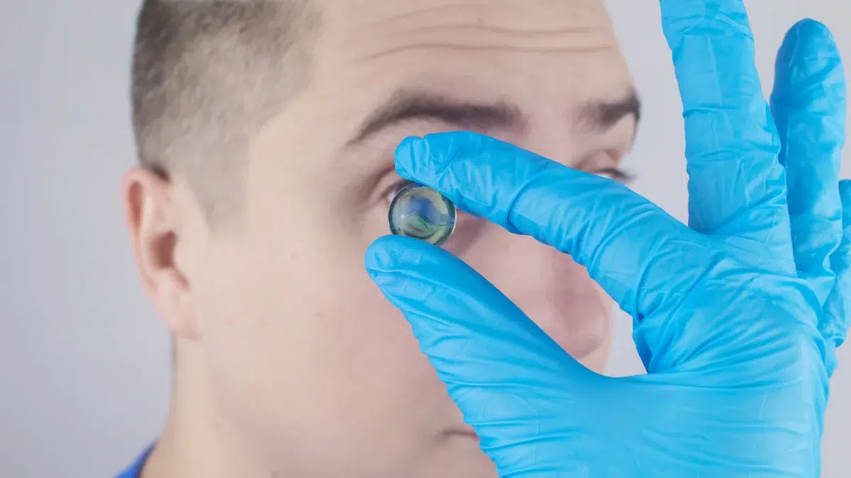 cataracts