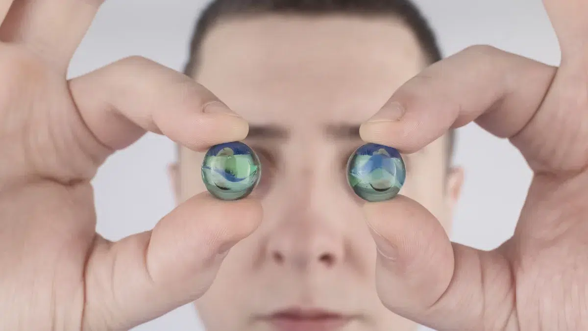 congenital cataracts