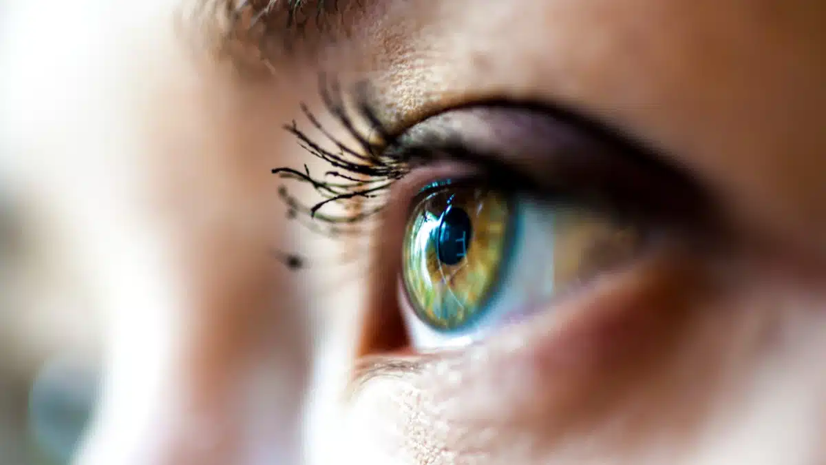 how to reduce floaters in eyes naturally