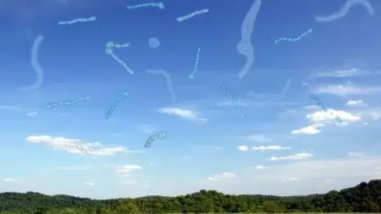 Eye floaters