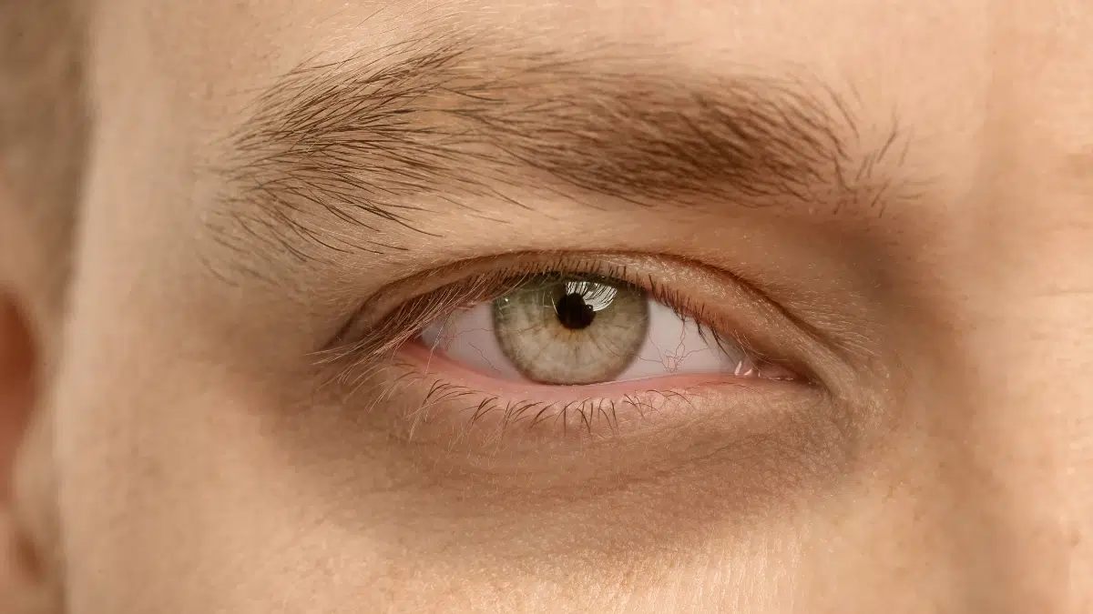 how to get rid of puffy eyes