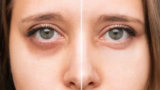 products for dark circles
