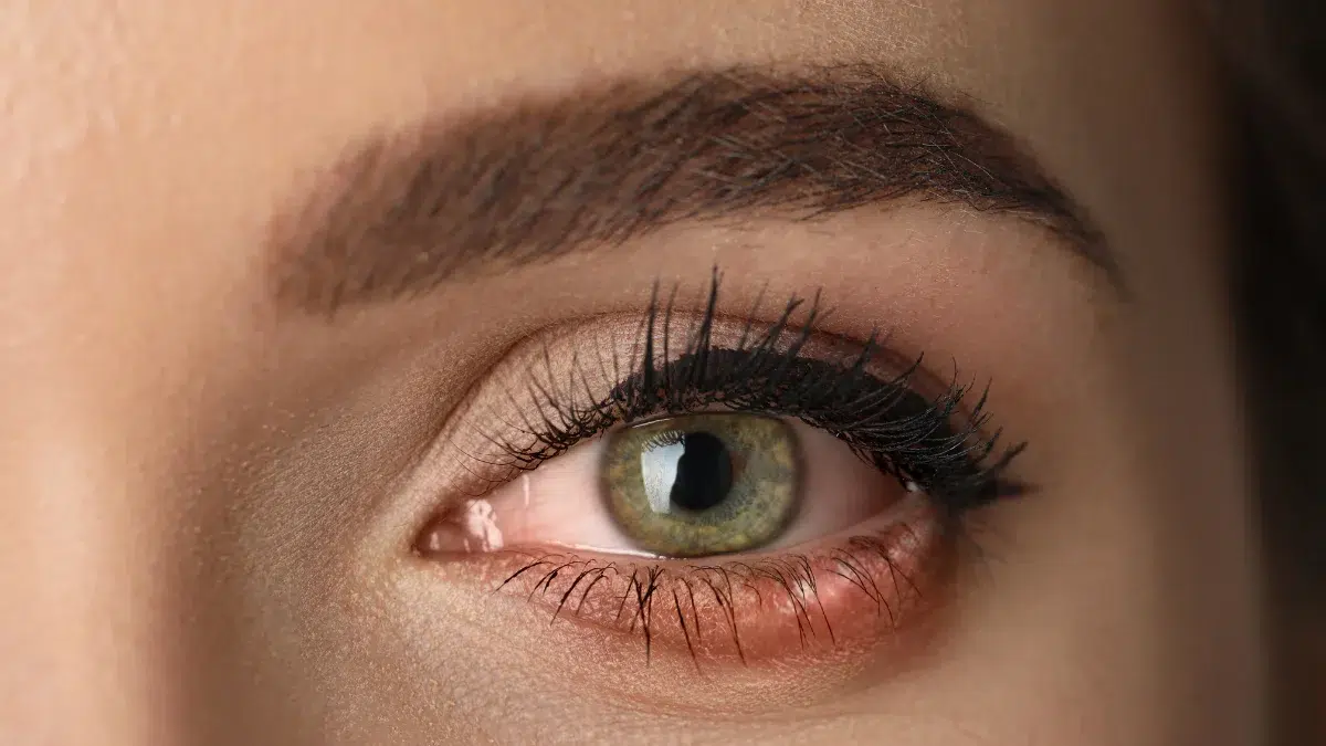 red eyes from allergies