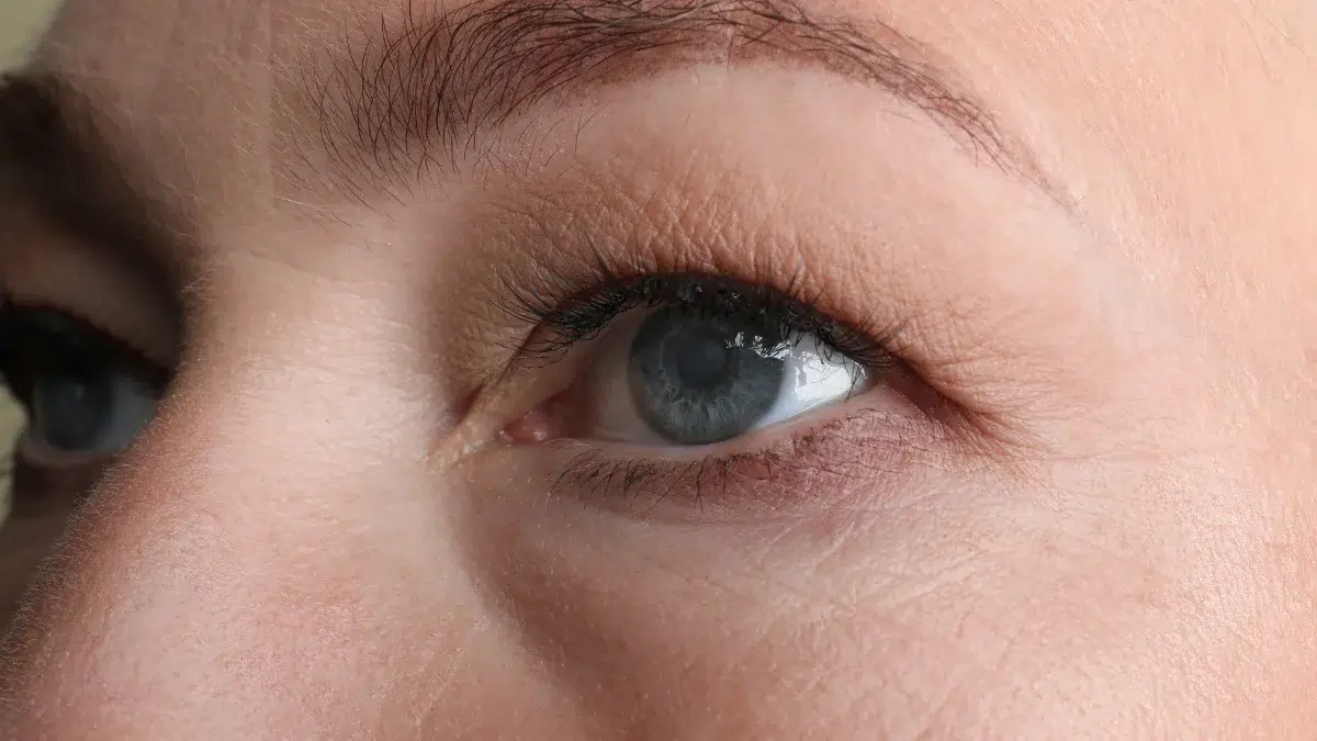 self test for cataracts