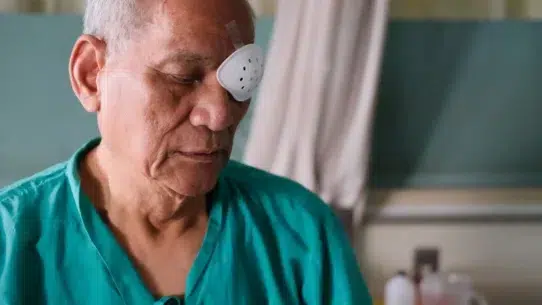 cataract surgery