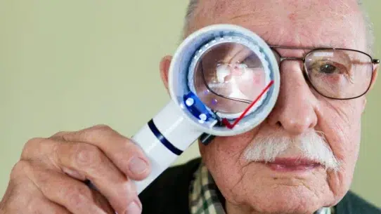 what causes macular degeneration