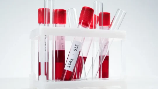 is pcos a sexually transmitted disease