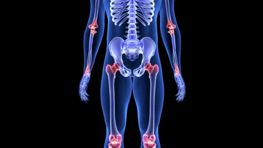menopause and joint pain