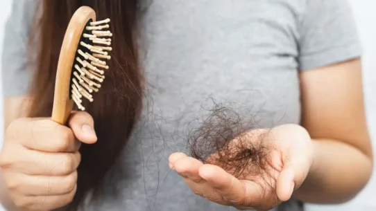 menopausal hair loss