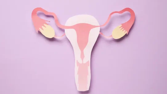 fibroids