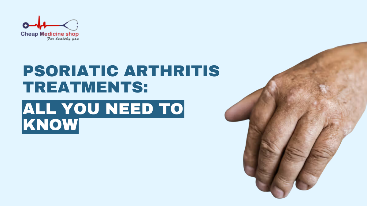 Psoriatic Arthritis Treatments: All you Need to Know